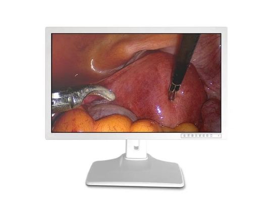 Pantalla de monitor médica del endoscopio 32inch 3840 x 2160