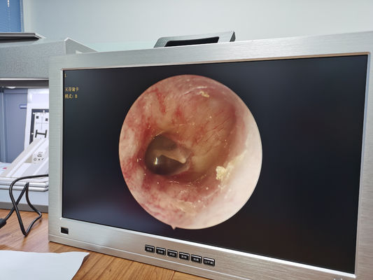 HD lleno 1080P 4 en 1 uno integró el sistema médico portátil de la cámara del endoscopio