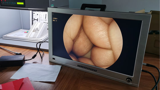 El monitor de 22 pulgadas integró el sistema completo ENT del sistema de la cámara del endoscopio de HD portátil
