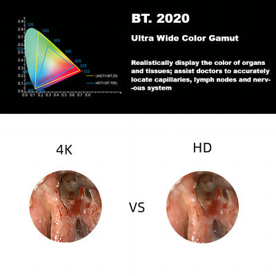 Nuevo 4K ultra HD sistema médico de la cámara del endoscopio de DEC 3840A para la laparoscopia